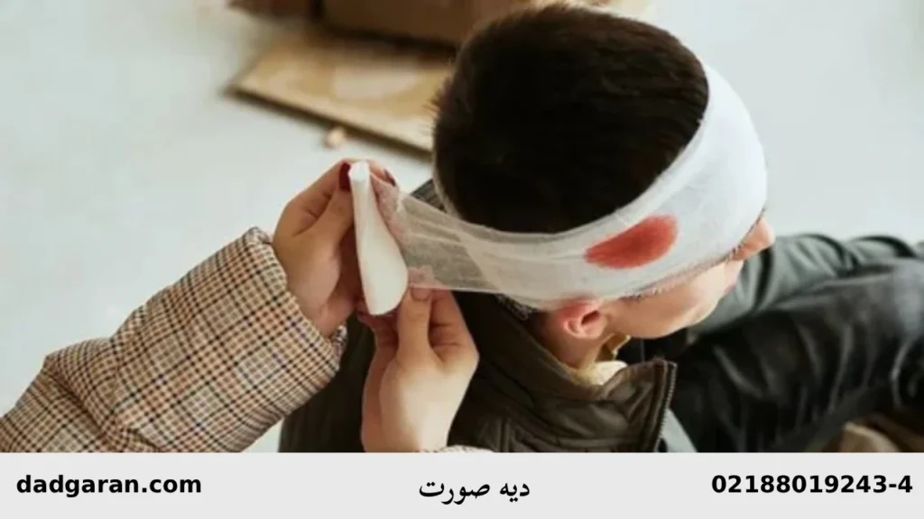 مبلغ دیه صورت-دادگران حامی