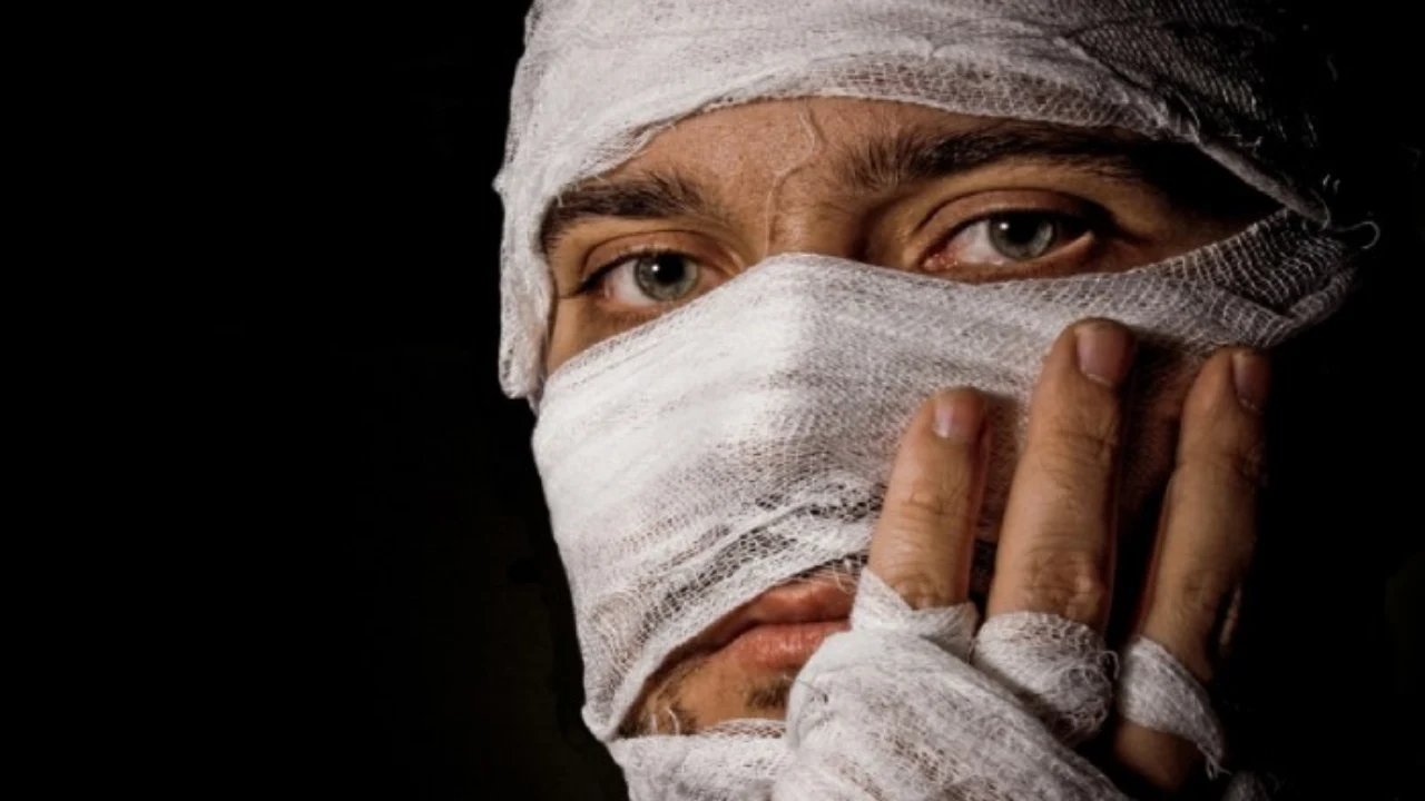 مقدار دیه جراحت صورت-دادگران حامی