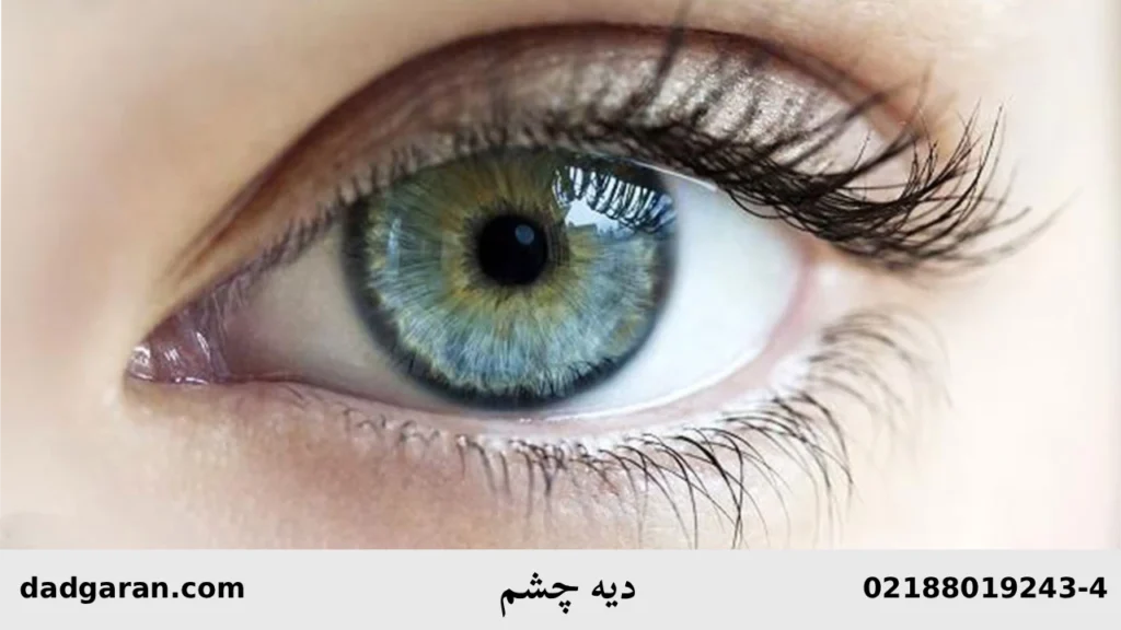 مبلغ دیه چشم-دادگران حامی